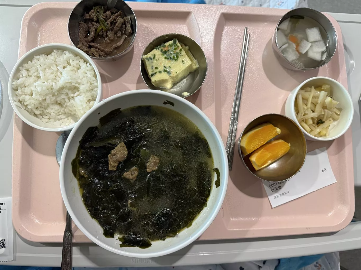 서울의료원 유도분만 후 제왕절개 출산 후기, 1인실 총비용 및 주차 꿀팁까지 10 서울의료원 병원밥